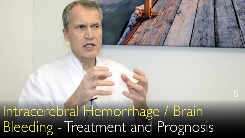 Intracerebral Hemorrhage. Treatment and prognosis of brain bleeding. 8