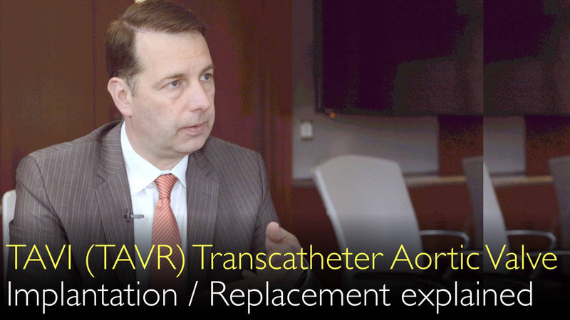 Объяснение транскатетерной имплантации аортального клапана (замена). ТАВИ или ТАВР. 2