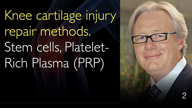 Методы лечения повреждений коленного хряща. Стволовые клетки и обогащенная тромбоцитами плазма (PRP) 2