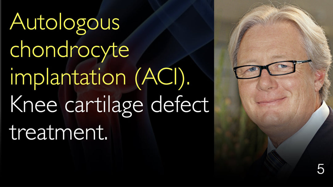 Autologous chondrocyte implantation (ACI). Knee cartilage defect treatment. 5