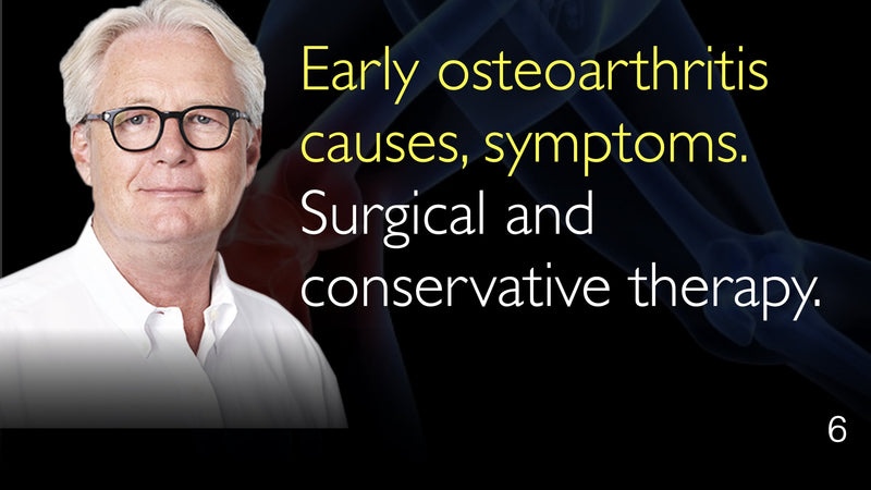 Ранний остеоартроз причины, симптомы. Хирургическая и консервативная терапия. 6