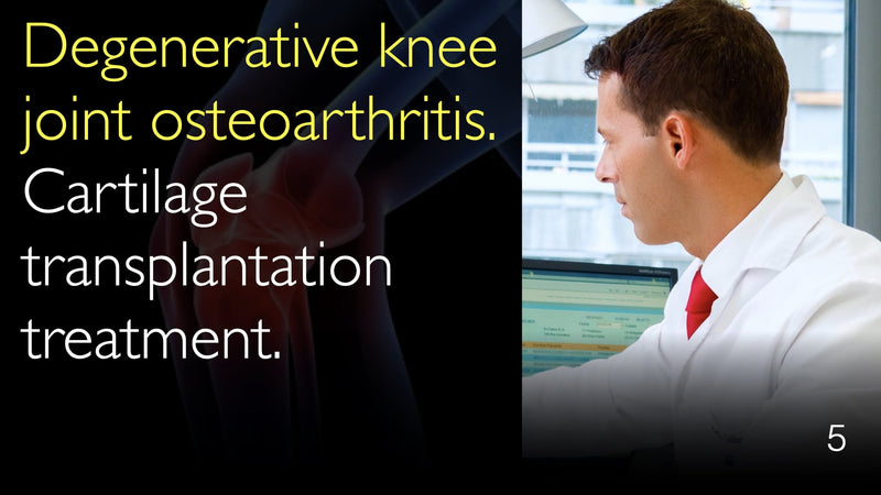 Дегенеративный остеоартроз коленного сустава. Лечение трансплантацией хряща. 5
