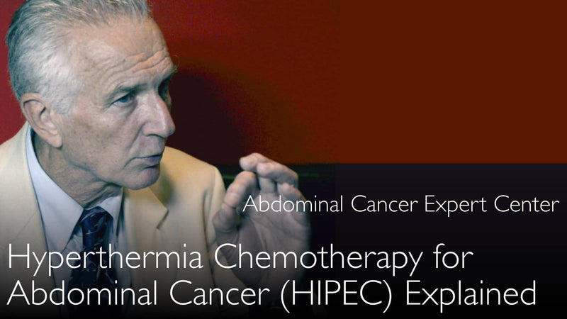 Гипертермическая химиотерапия при раке брюшины. Зачем применять тепло? HIPEC. 6